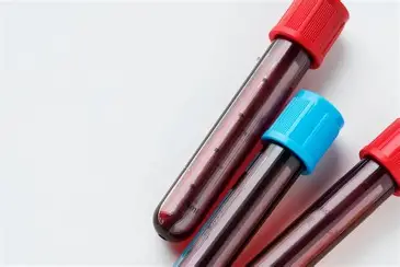 血液検査でアレルギーを特定